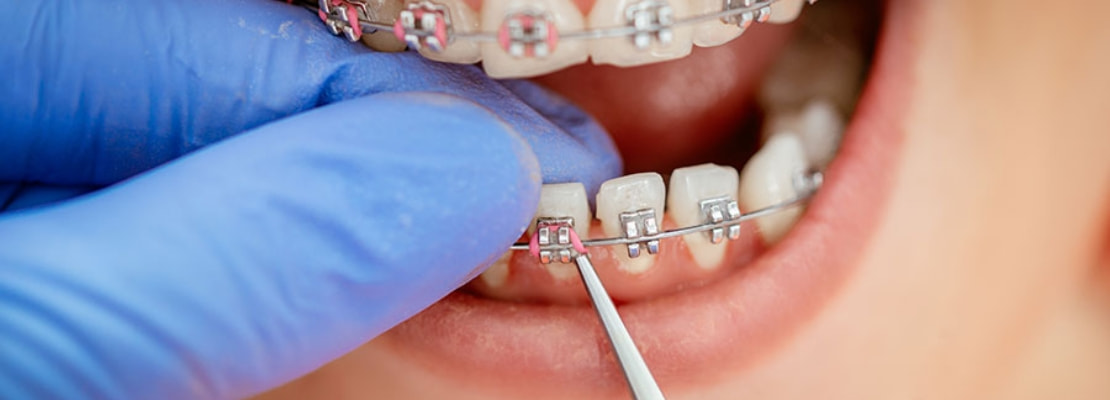 Conheça mais sobre Ortodontia